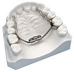 palatal expander